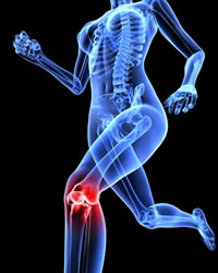 Illustration of knee impact in X-Ray